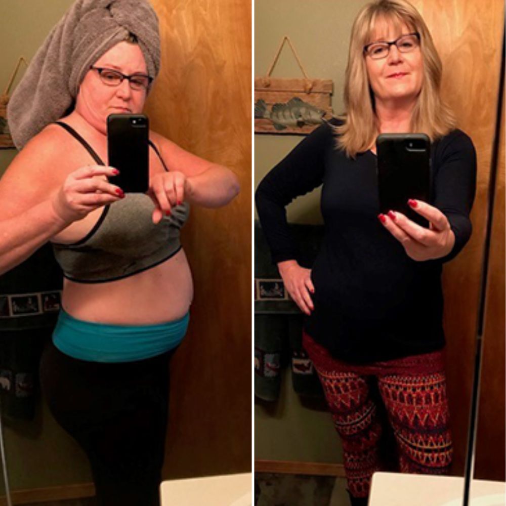 Dawn K. before and after