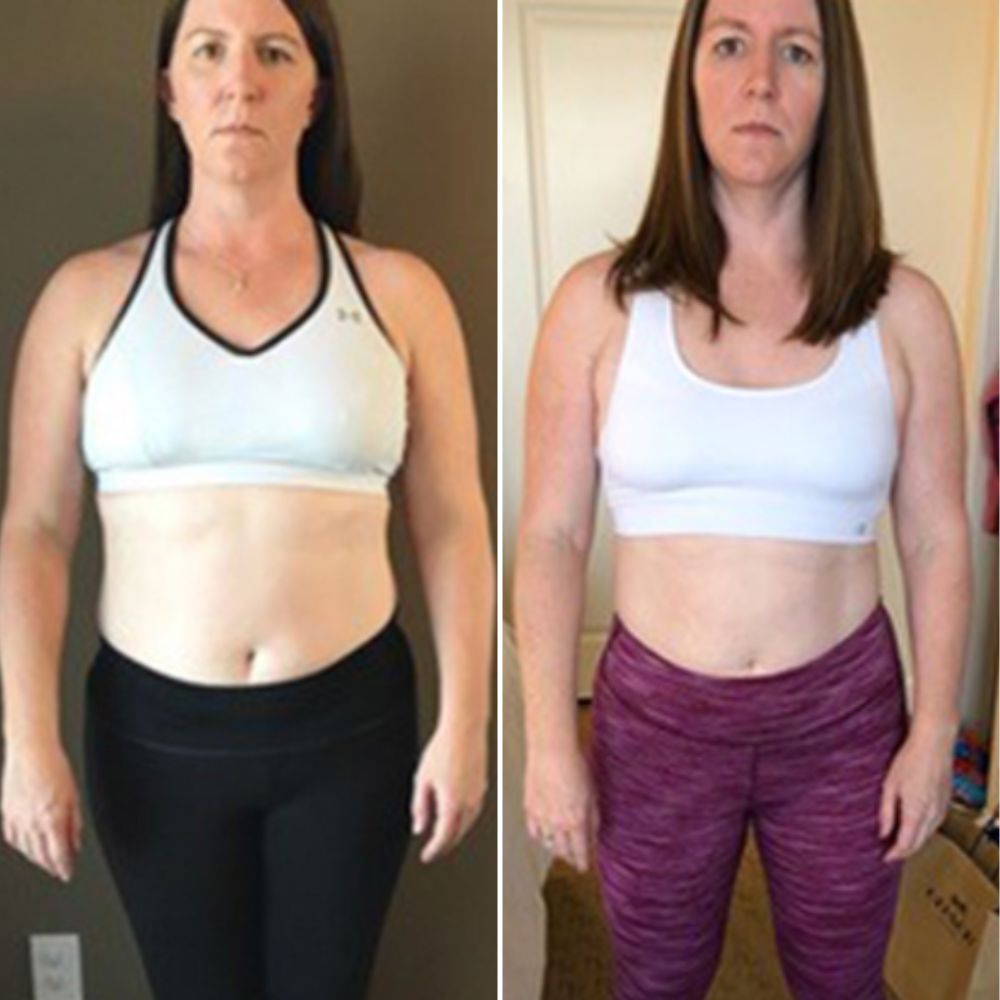 Traci C. before and after